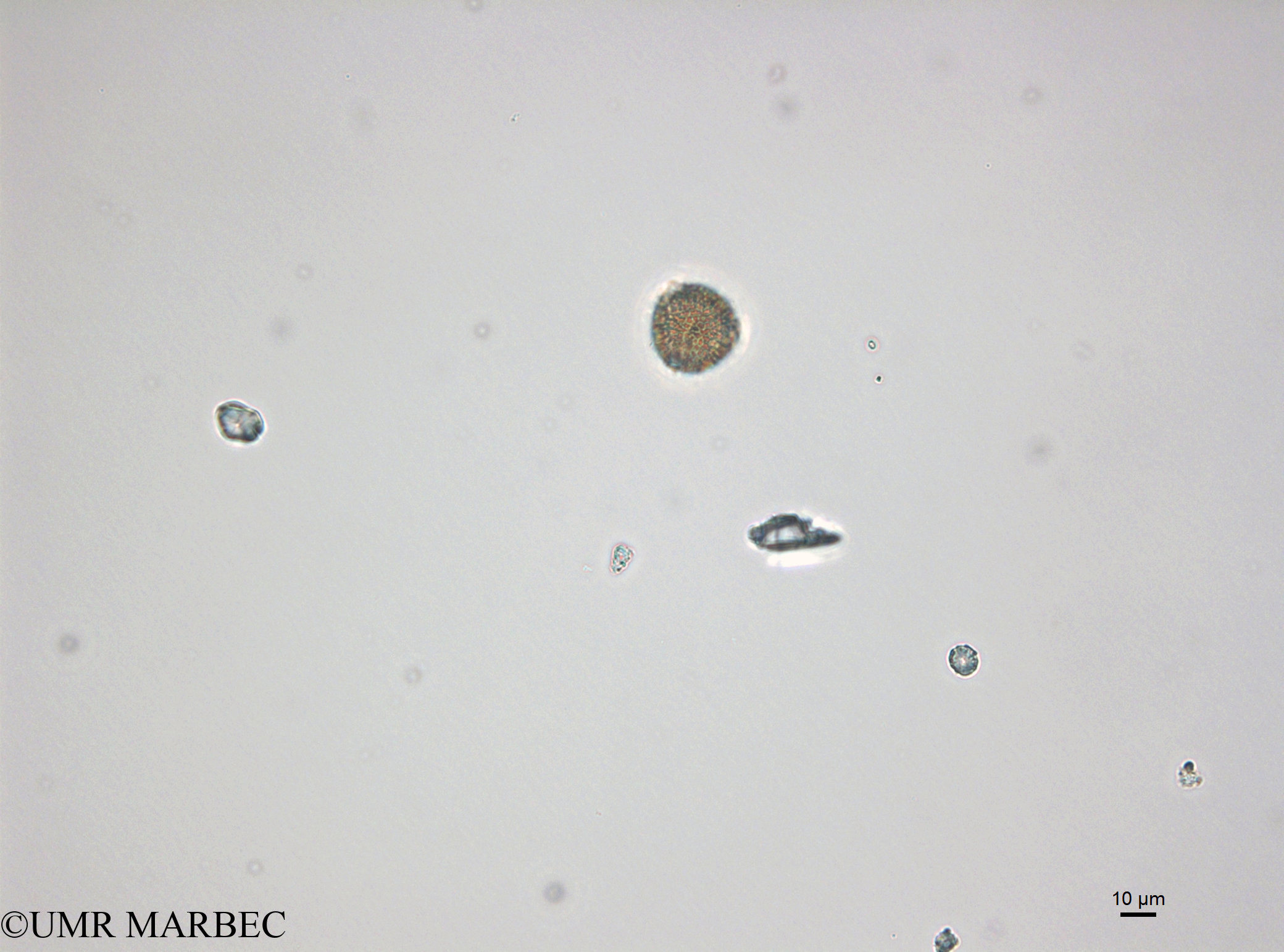 phyto/Bizerte/bizerte_bay/RISCO April 2014/Triceratium sp2 (141201_001_ovl)(copy).jpg